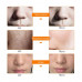 Colorful LED Beauty Mask Led-face pack, white