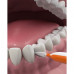 Brushes for interdental intervals of DenTek Convenient clarification for standard intervals, 10 pieces